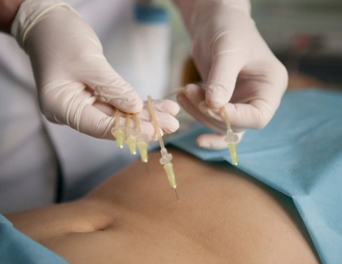 Озонотерапия - Оздоровительные услуги - Санаторий «Здоровье» Железноводск